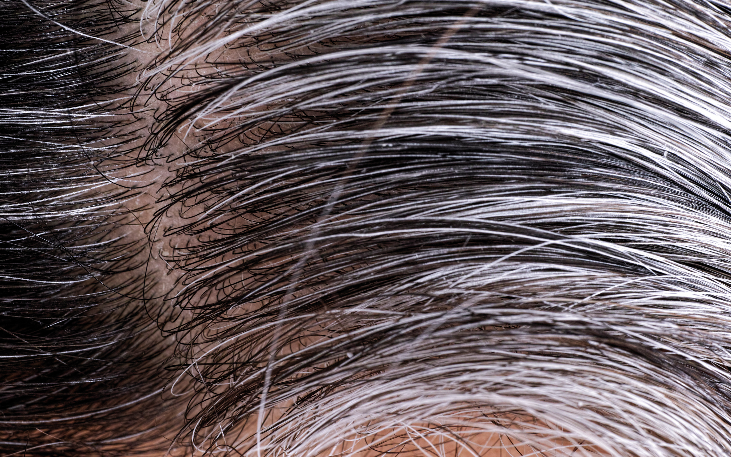 Factsheet Geriatrische revalidatiezorg